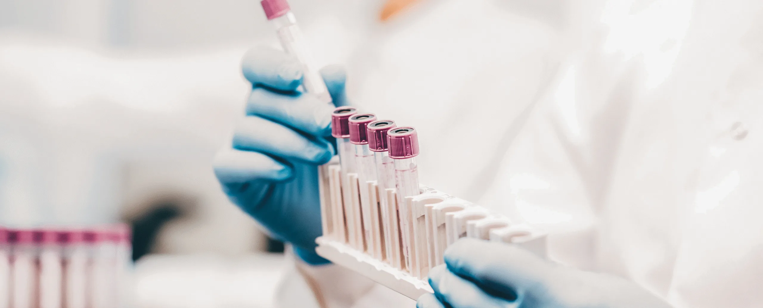 Lab work
