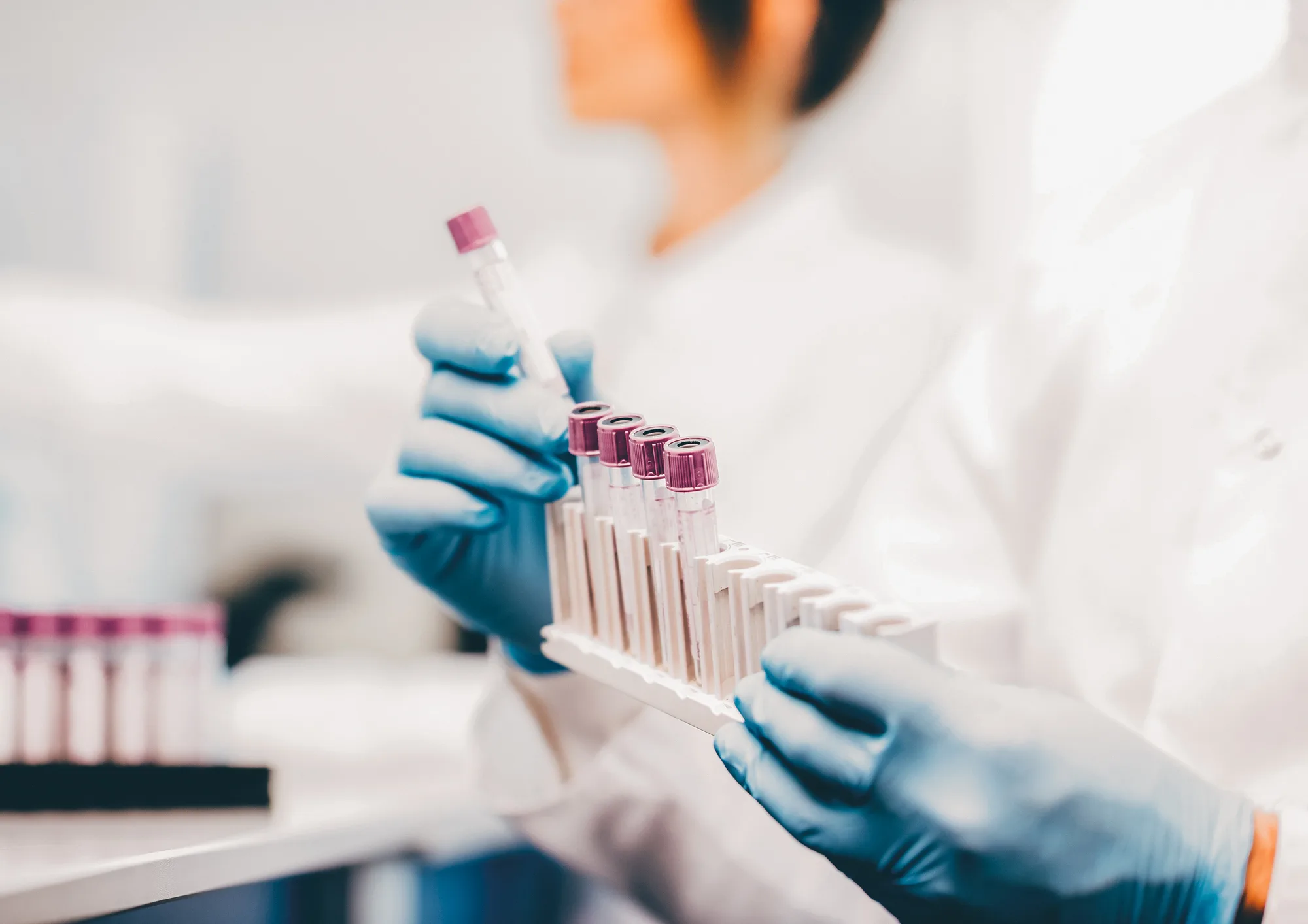 scientist making samples in a lab